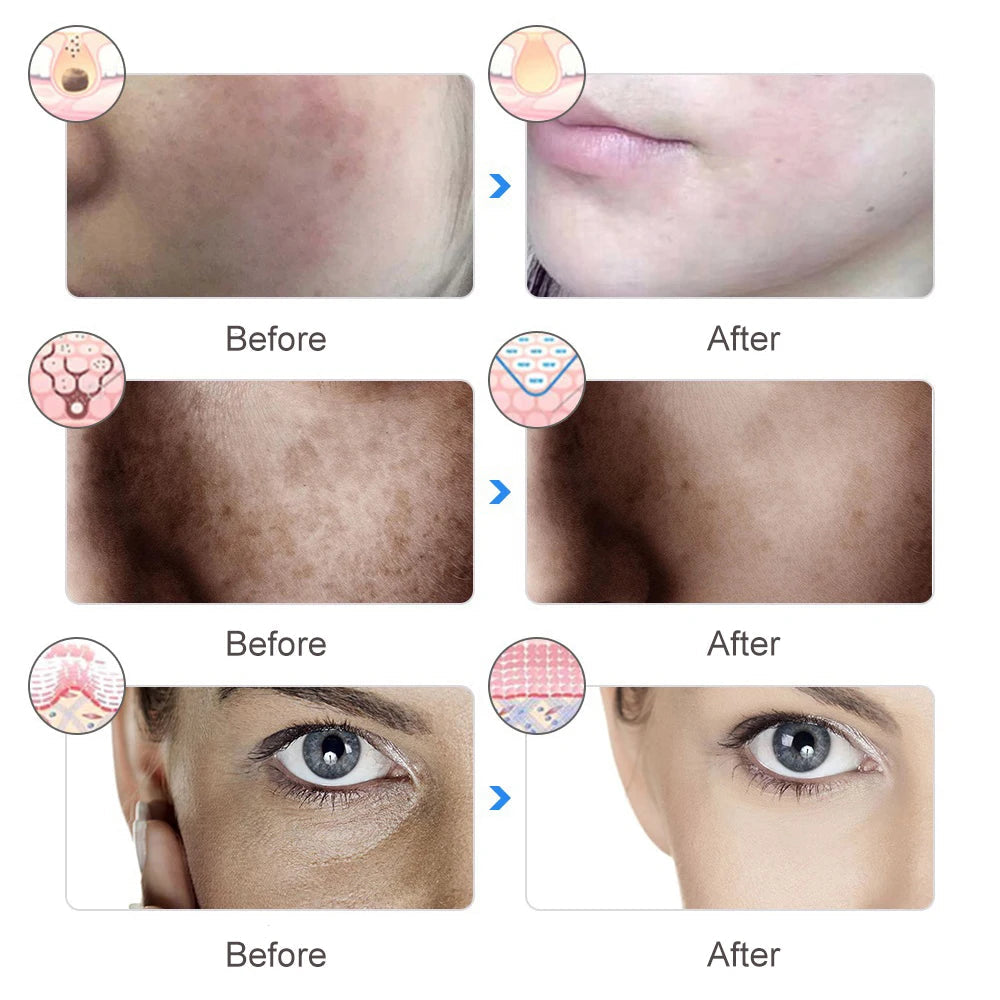 GLOWÉA 7-Wavelength LED Light Therapy Mask for Face & Neck GLOWÉA