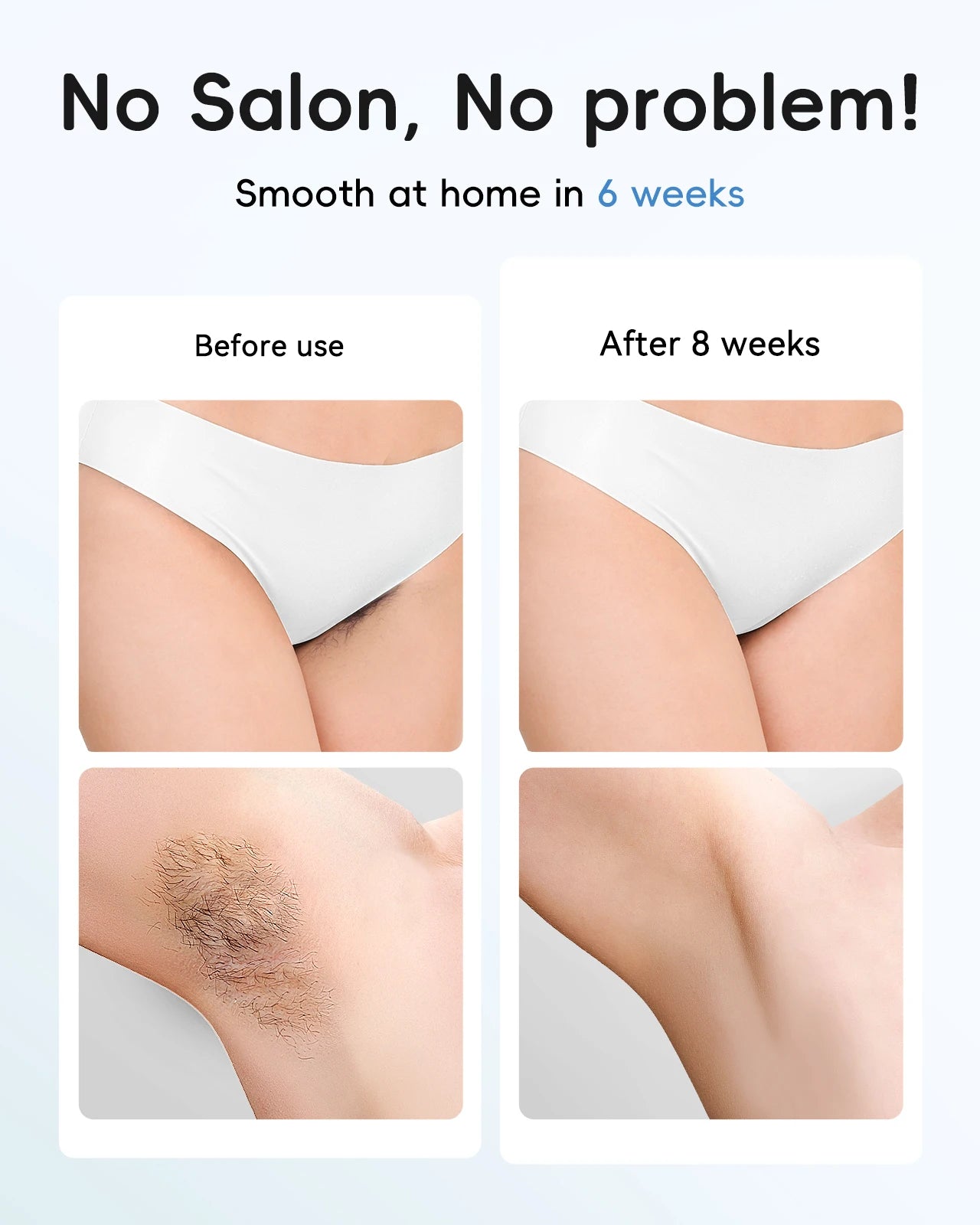 GLOWÉA IPL Laser Epilator for Hair Removal - Painless Home Device GLOWÉA