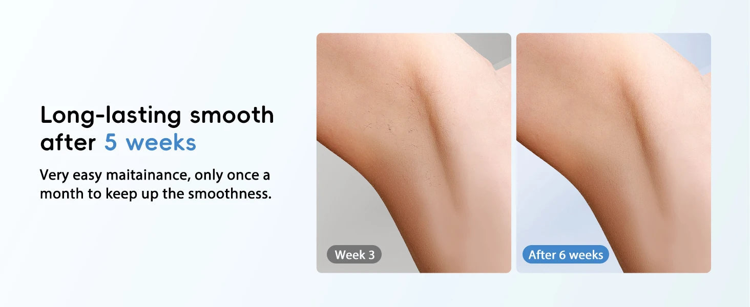 GLOWÉA IPL Laser Epilator for Hair Removal - Painless Home Device GLOWÉA