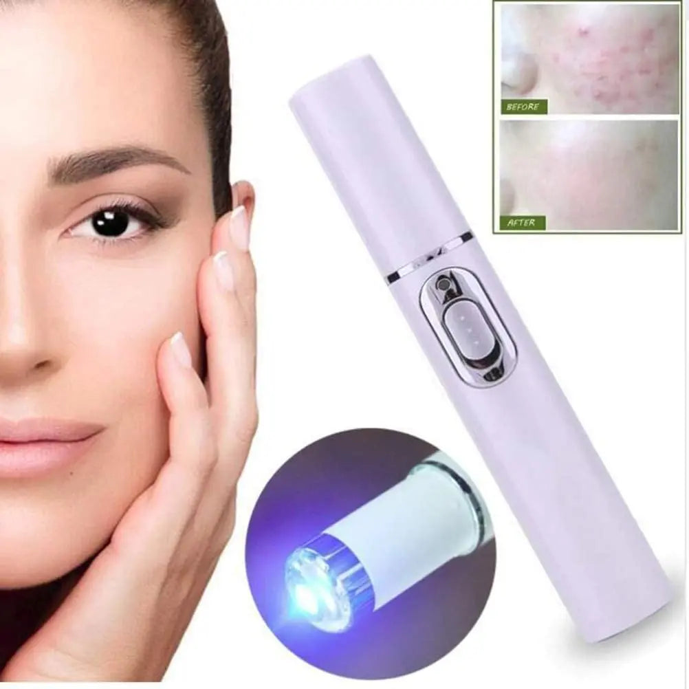 Stylo laser de luminothérapie bleue GLOWÉA pour les varices et l'acné