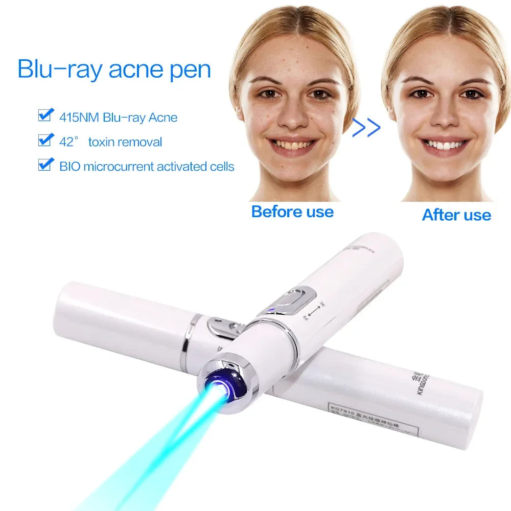 Stylo de luminothérapie bleue GLOWÉA pour le traitement de l'acné et des rides
