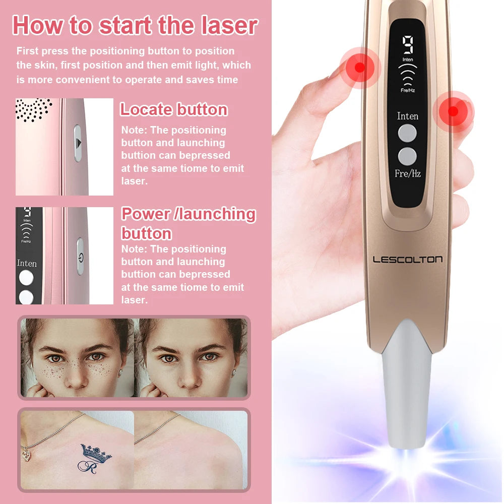 Stylo laser picoseconde GLOWÉA Lescolton - Thérapie par lumière bleue