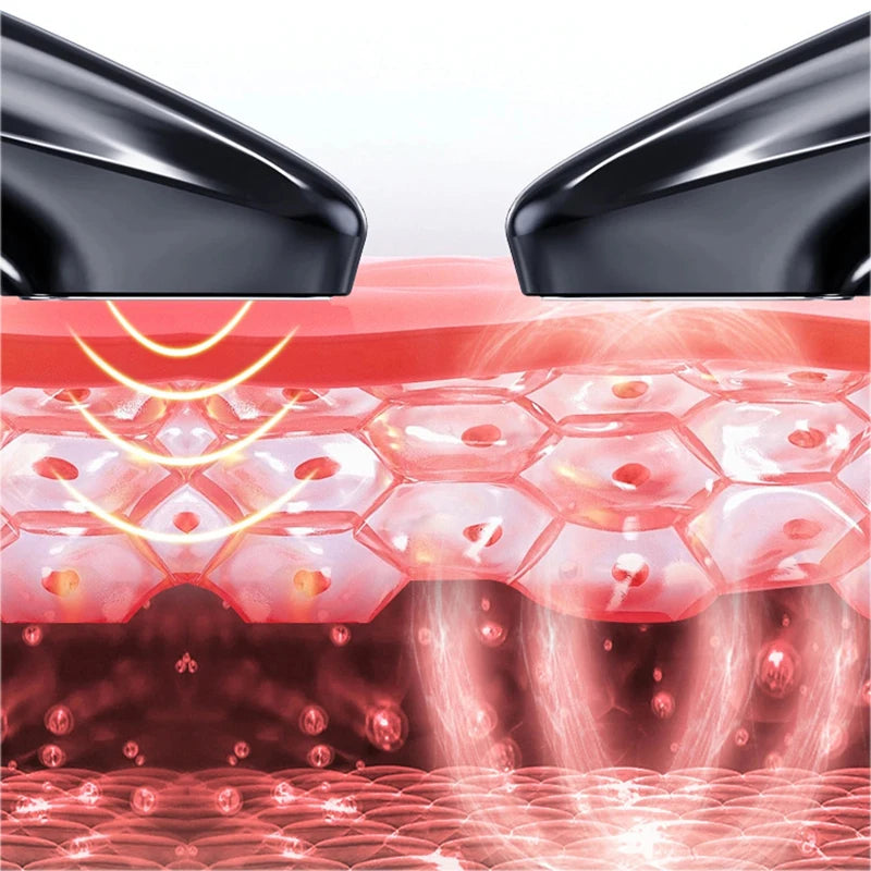 Stylo plasma froid à l'ozone GLOWÉA - Traitement de l'acné par lumière bleue