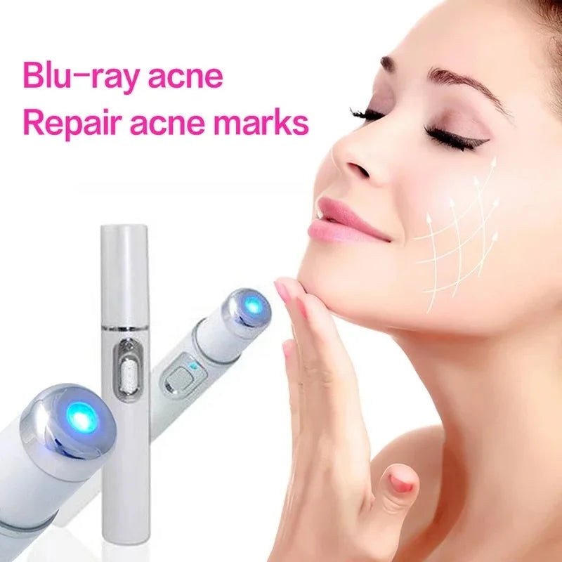 Stylo laser anti-acné et anti-rides GLOWÉA - Traitement à la lumière bleue