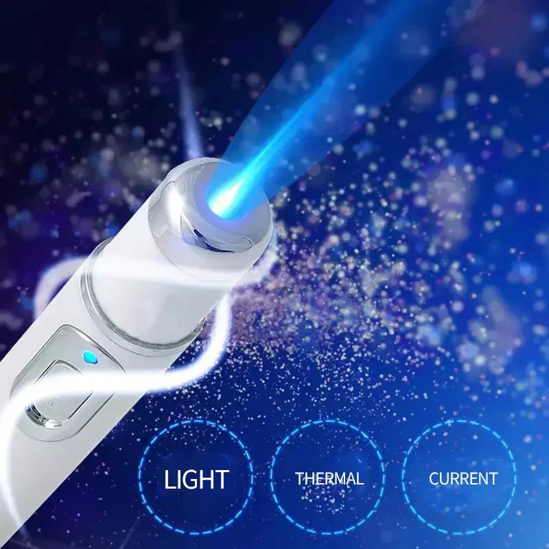 Stylo laser GLOWÉA pour l'élimination de l'acné et des rides par thérapie par lumière bleue