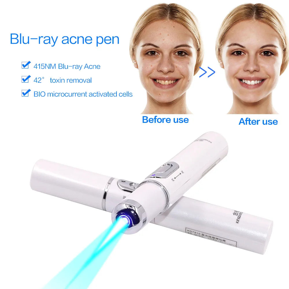 Stylo laser à lumière bleue pour le traitement de l'acné GLOWÉA